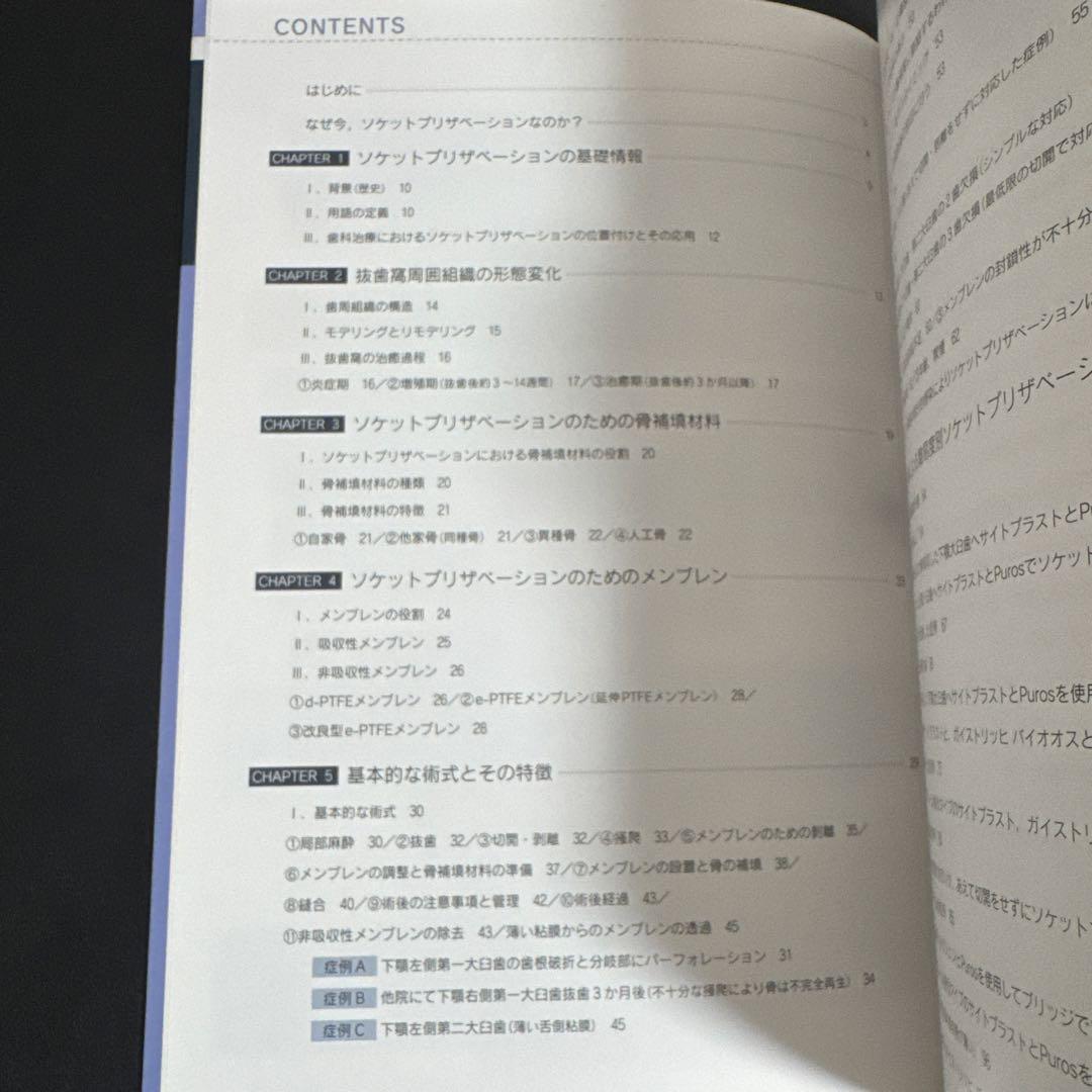 必ず上達 ソケットプリザベーション