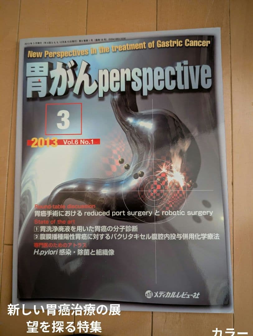 【超レア】胃がんperspective 3 2013 Vol.6 No.1