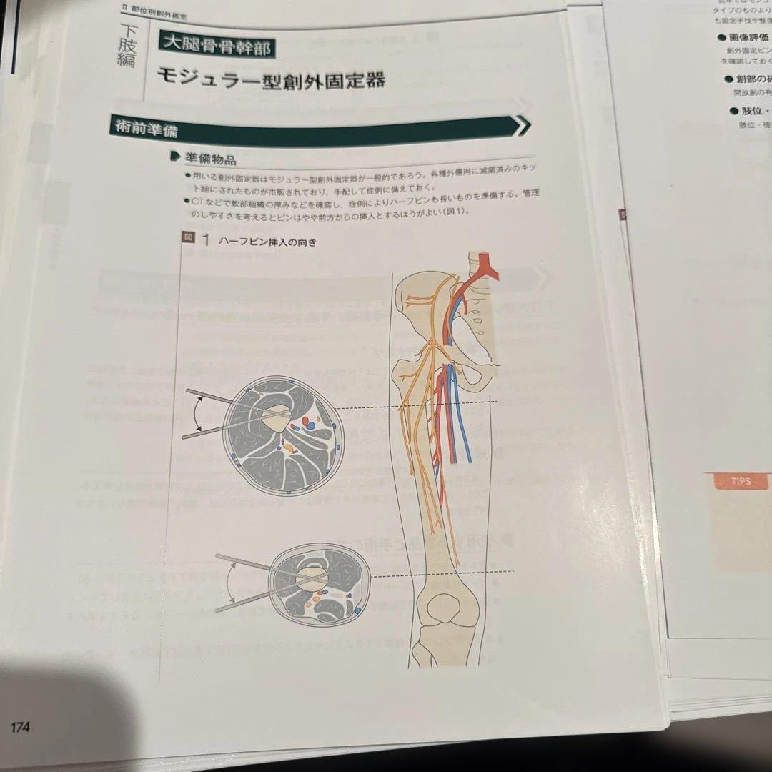 一時的創外固定マニュアル