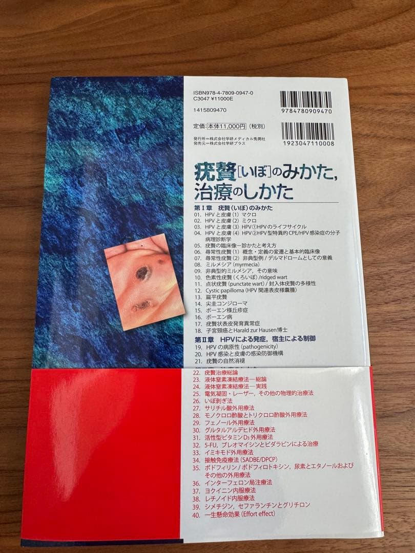 疣贅（いぼ）のみかた、治療のしかた