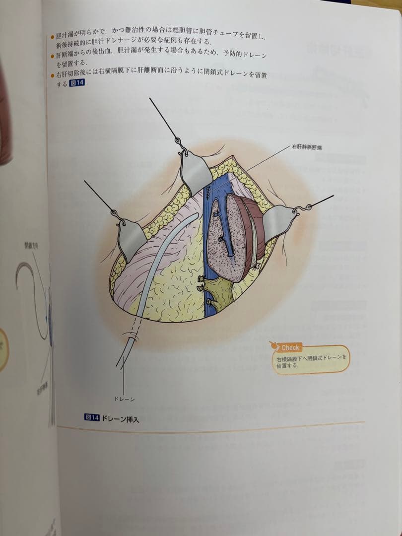 消化器外科手術 肝臓・脾臓 胆道・膵臓2点セット
