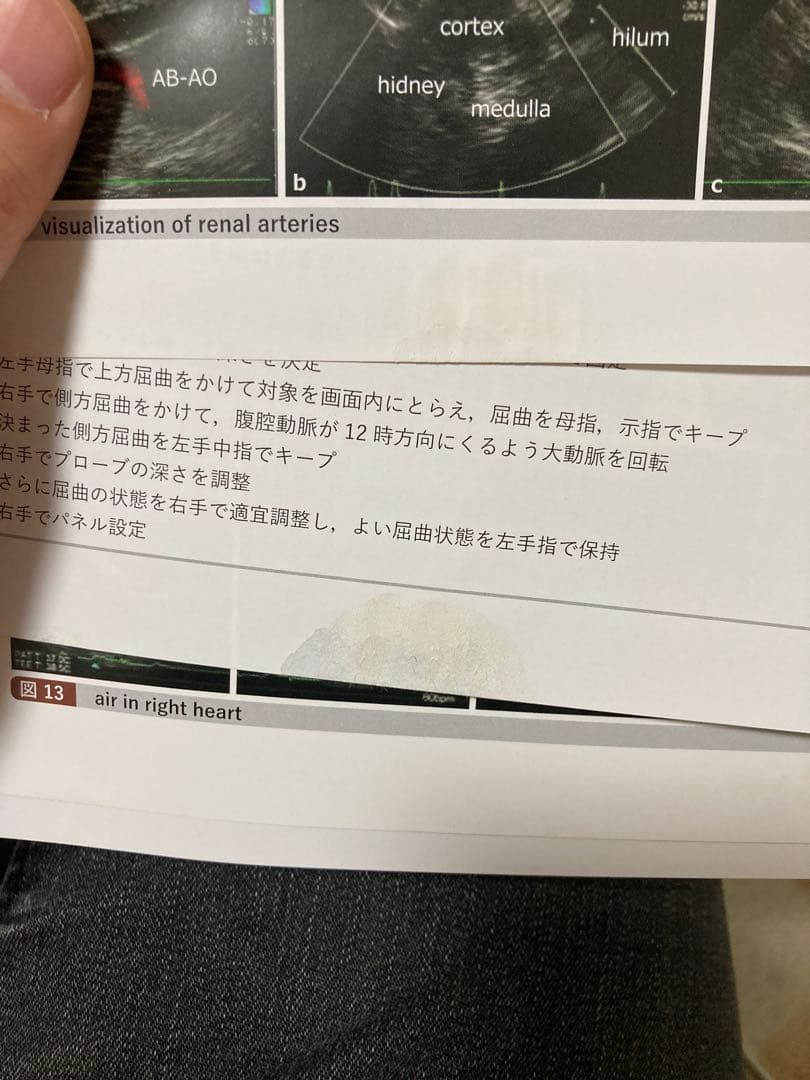 経食道心エコー法マニュアル 第5版