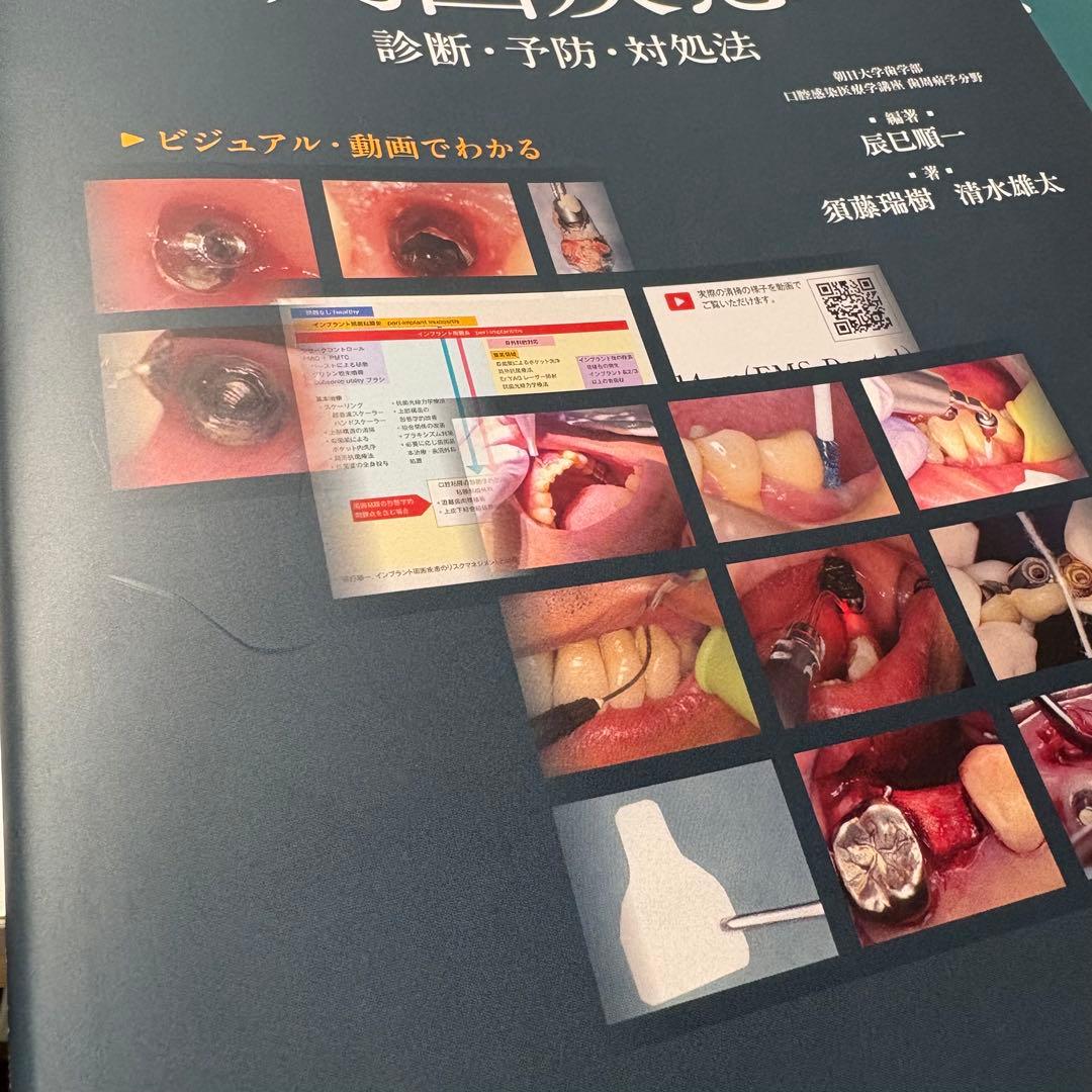 インプラント周囲疾患 診断・予防・対処法 裁断済み