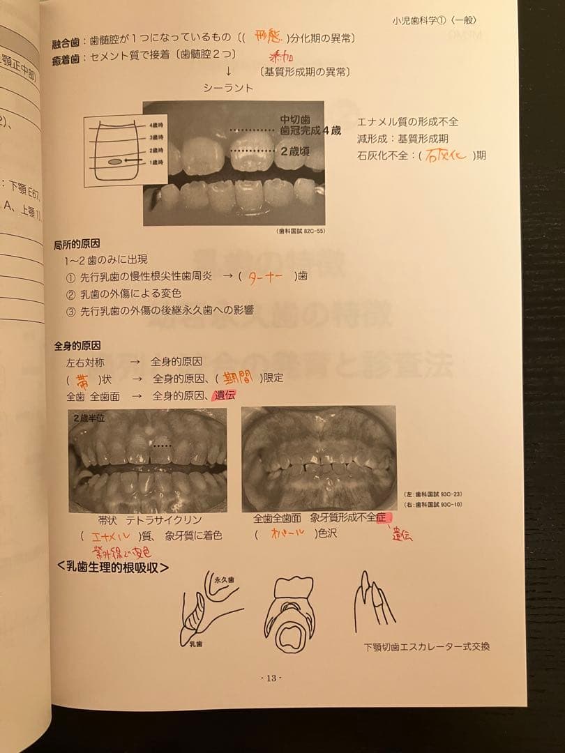 akt 118回歯科医師国家試験対策 Des予備校 小児歯科+保存修復