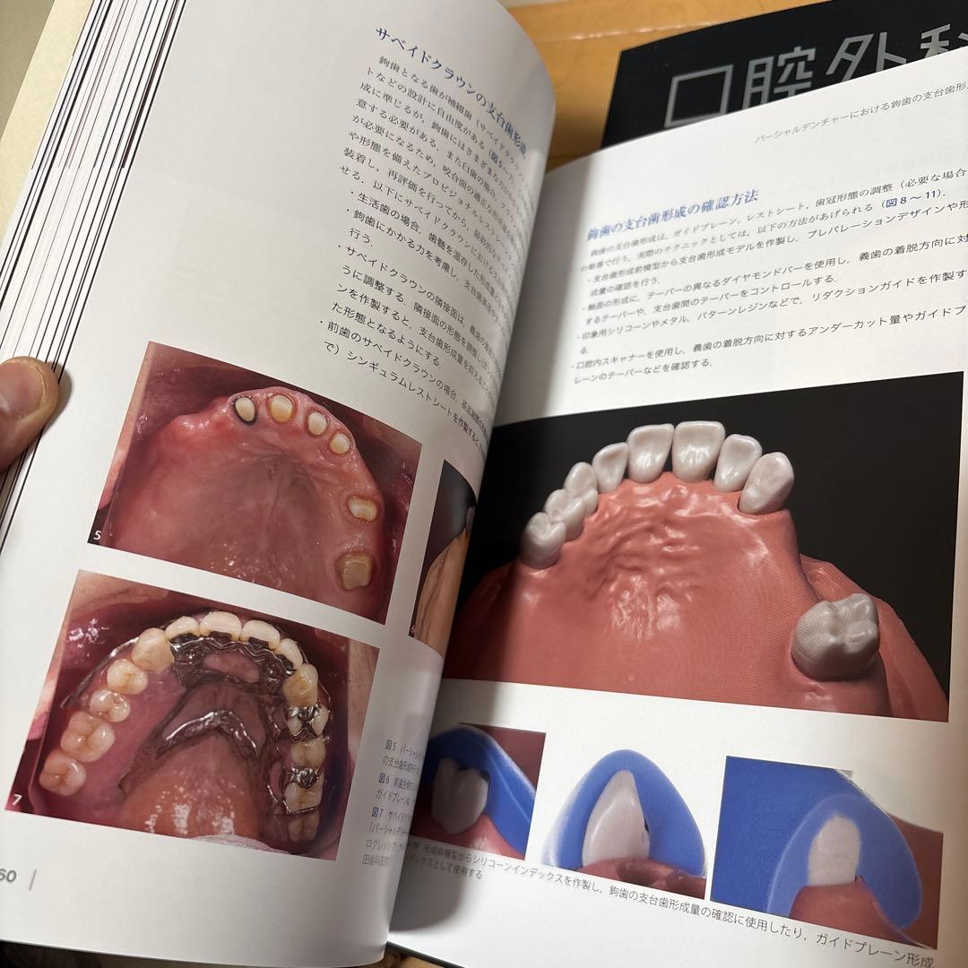 The Tooth Preparation : 補綴修復治療の成功を目指した支…