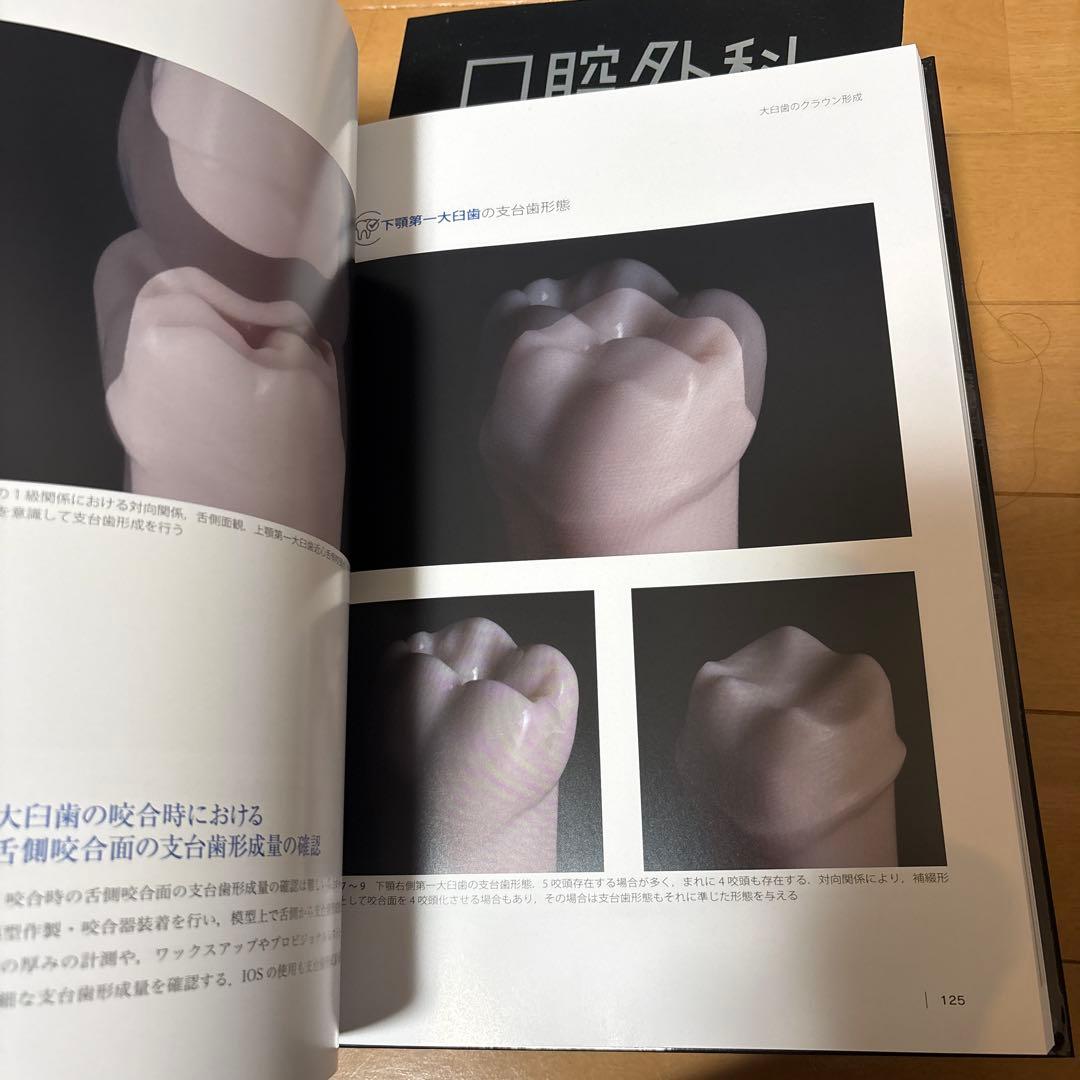 The Tooth Preparation : 補綴修復治療の成功を目指した支…