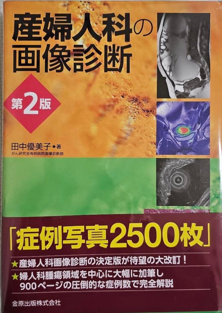【裁断済】産婦人科の画像診断 第2版