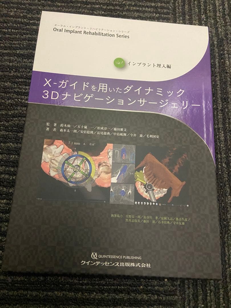 X-ガイドを用いたダイナミック3Dナビゲーションサージェリー