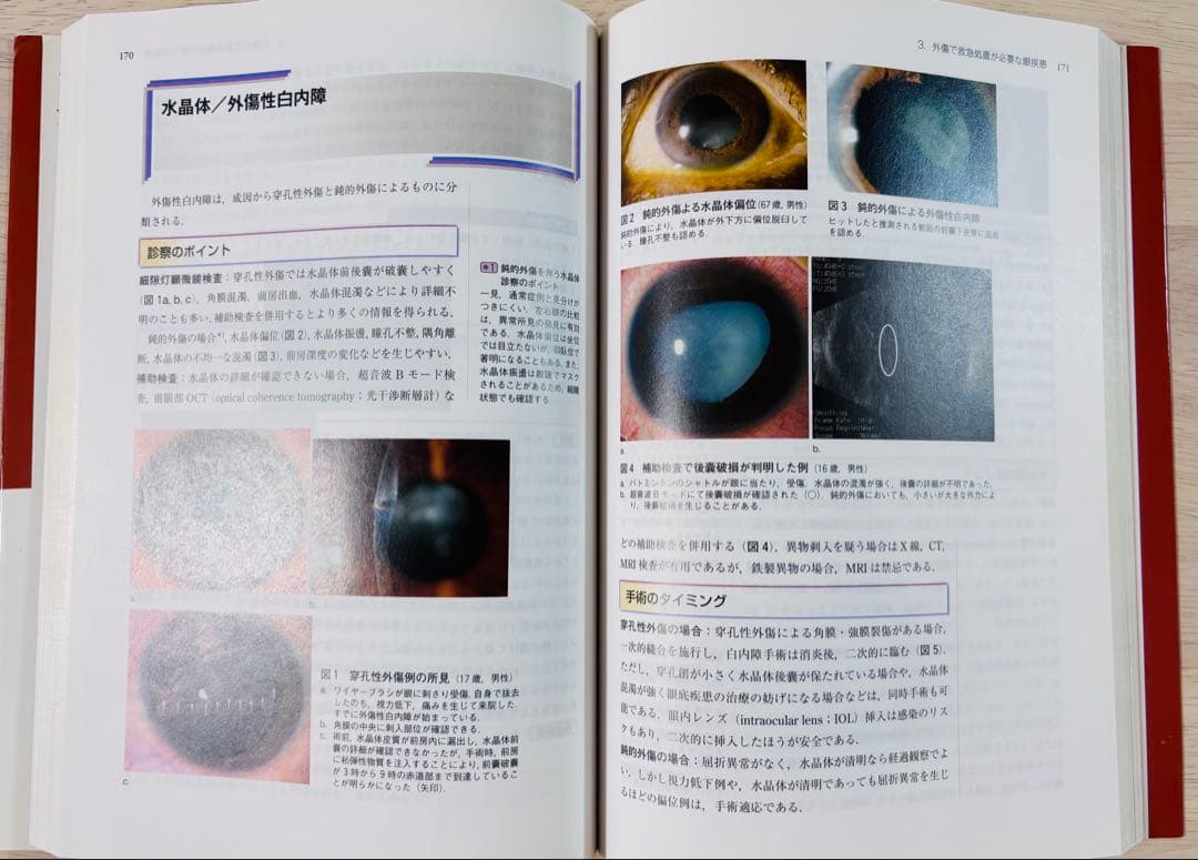 【美品・書き込みなし】眼科診療クオリファイ 21 眼救急疾患スクランブル