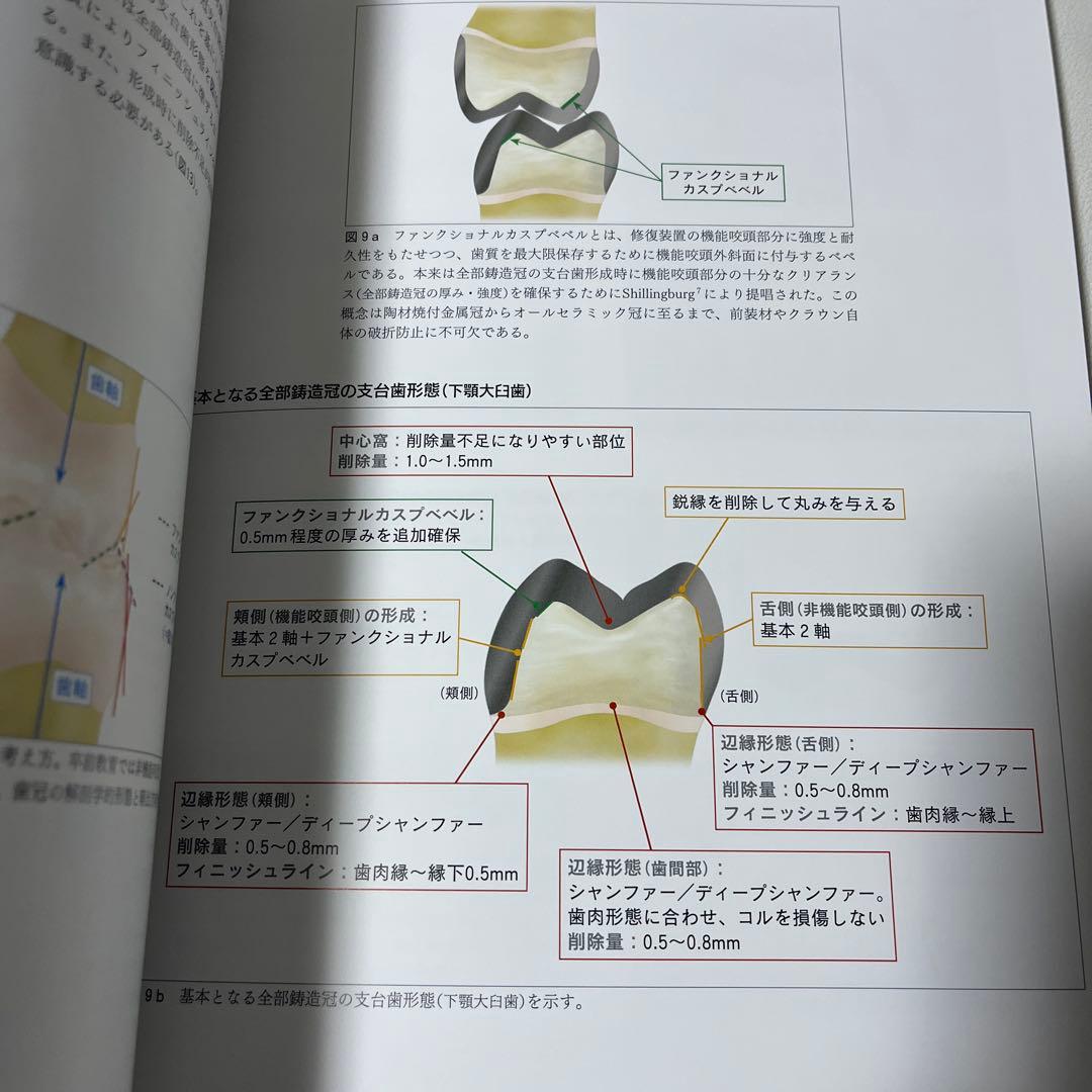 デジタル時代の歯冠修復