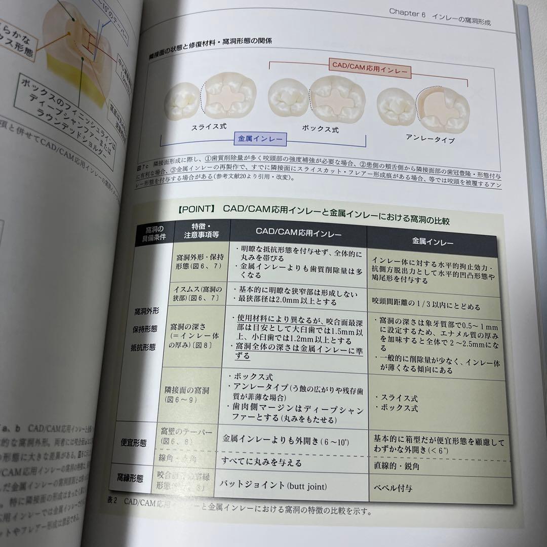 デジタル時代の歯冠修復