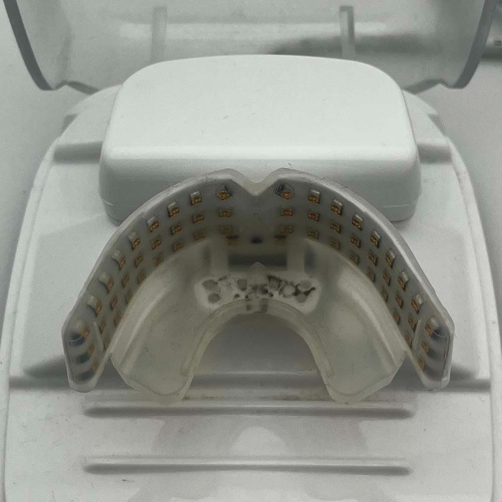 オルソパルス OrthoPulse