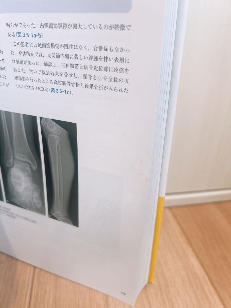 AO法骨折治療 Foot and Ankle [英語版Web付録付]