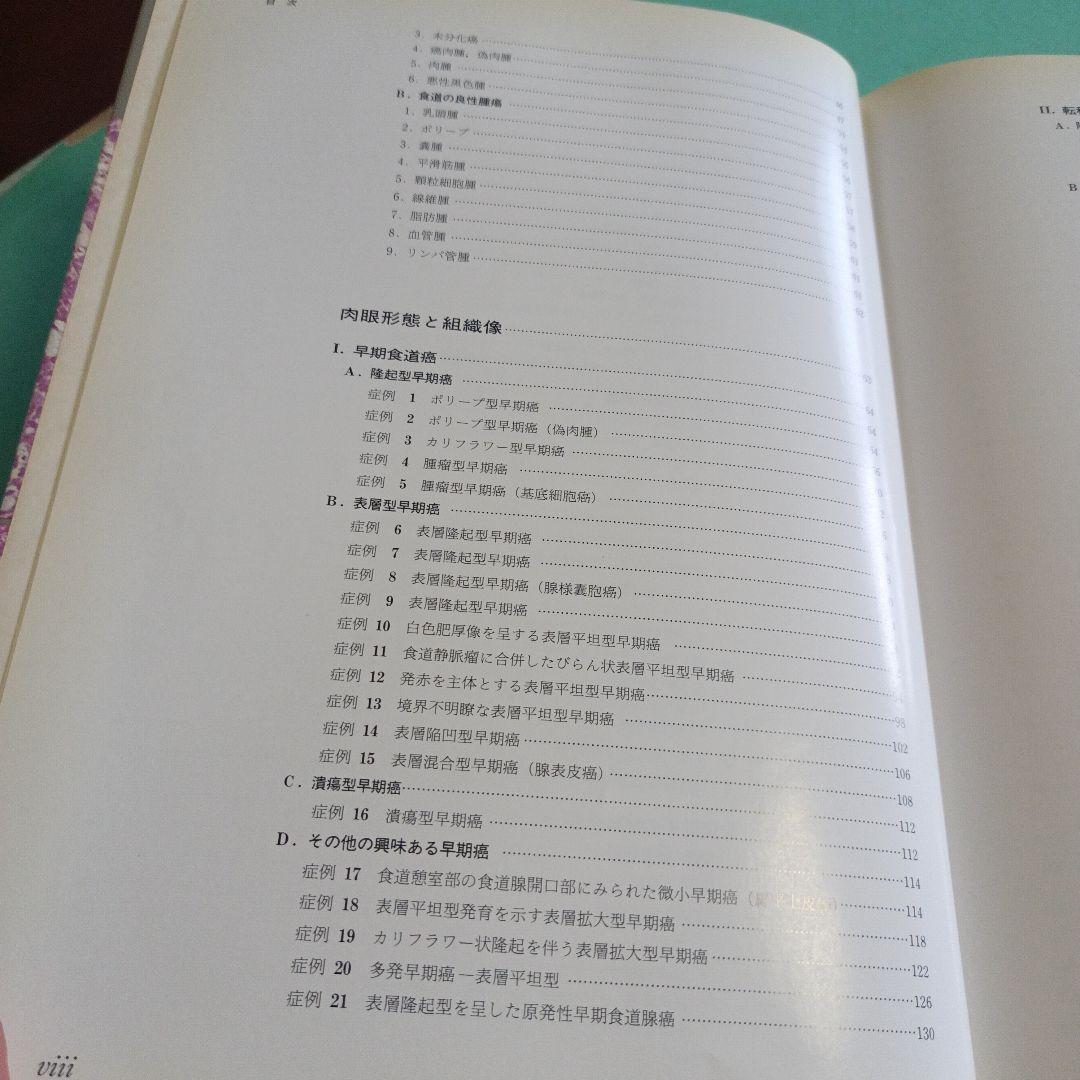 38♥♥♥♥食道腫瘍の臨床病理♥♥♥♥