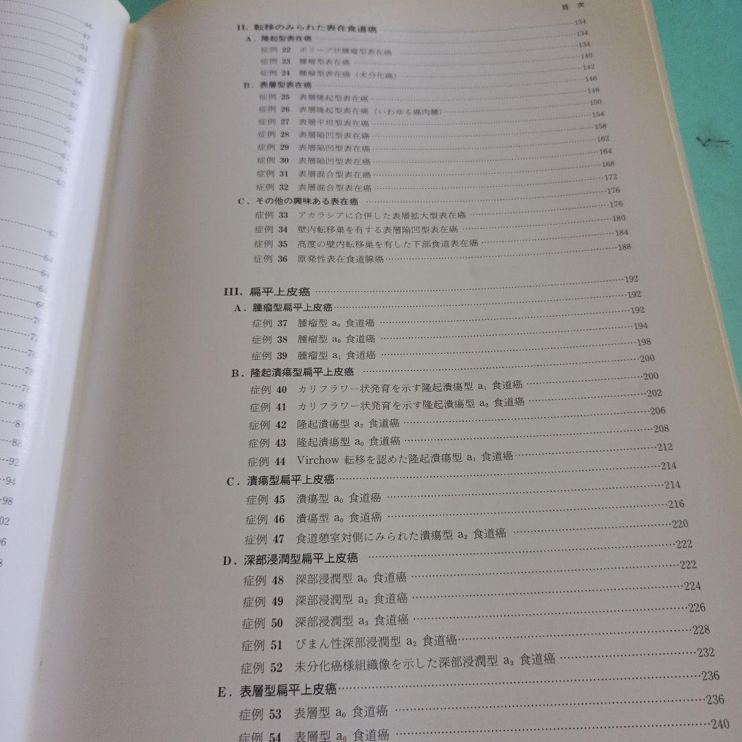 38♥♥♥♥食道腫瘍の臨床病理♥♥♥♥