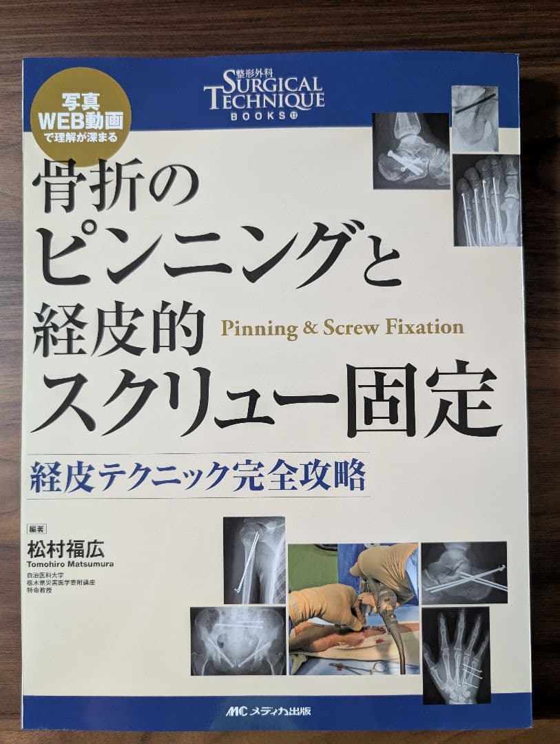 【すぬーぴーなっつ裁断済】骨折のピンニングと経皮的スクリュー固定