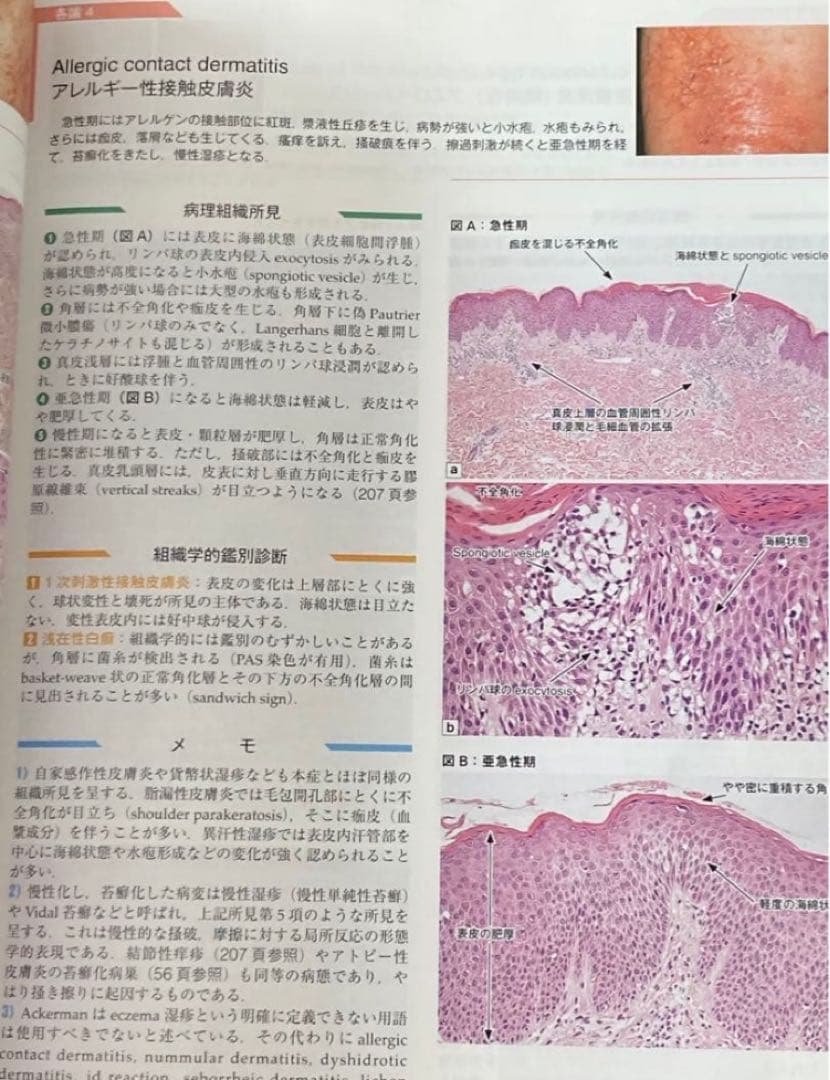 皮膚病理組織診断学入門　改訂第3版