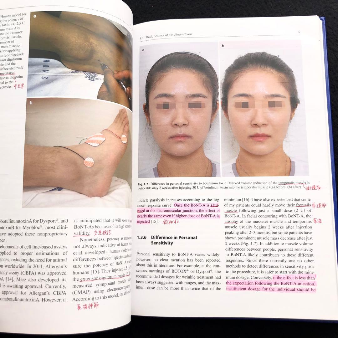 アジア人のためのボツリヌストキシン「Botulinum Toxin」