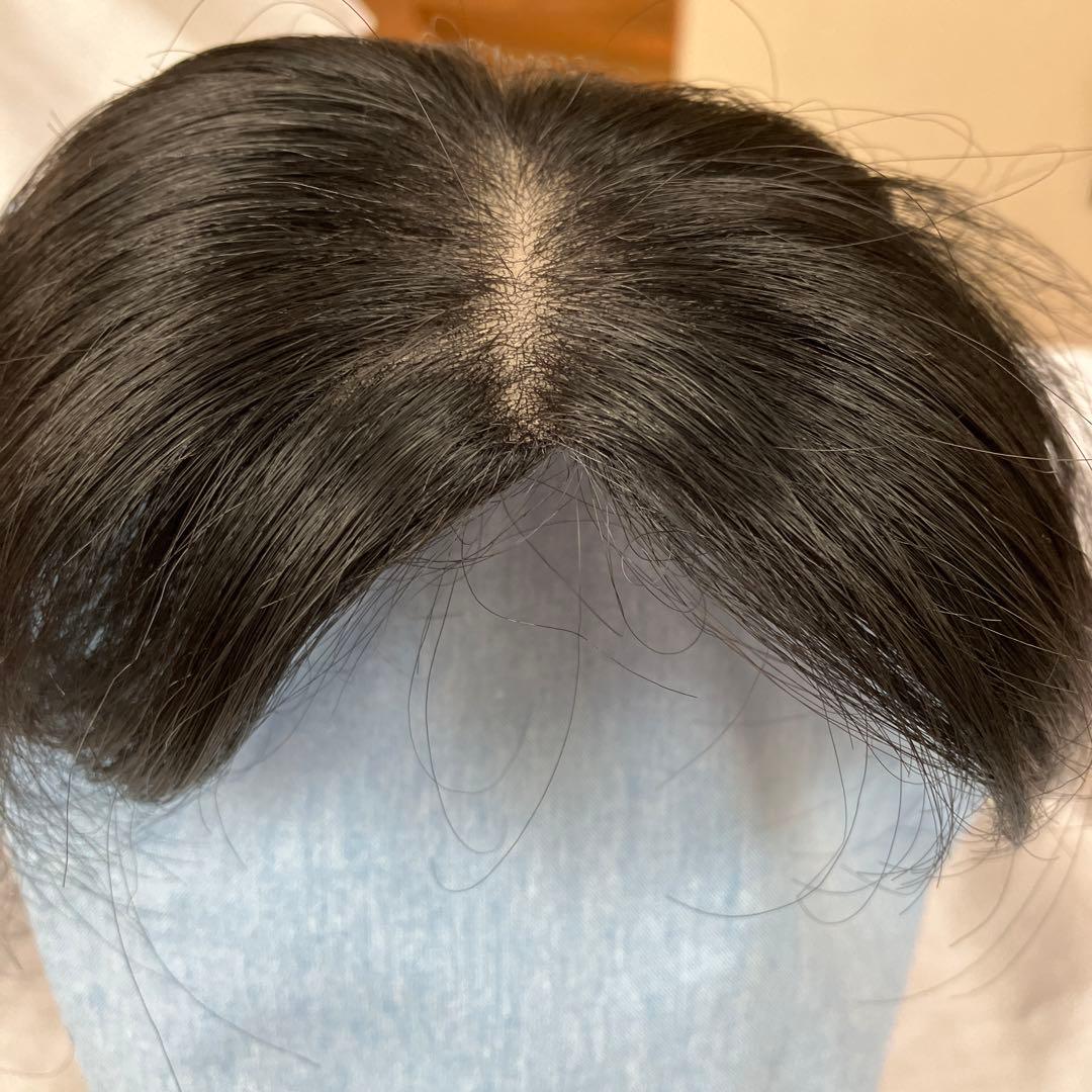 アデランス部分ウィッグ