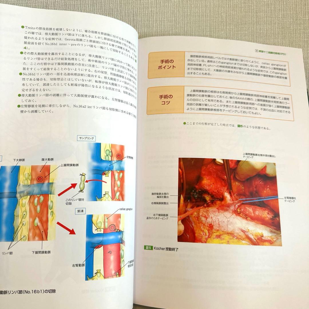 がん研スタイル 癌の標準手術 膵癌・胆道癌