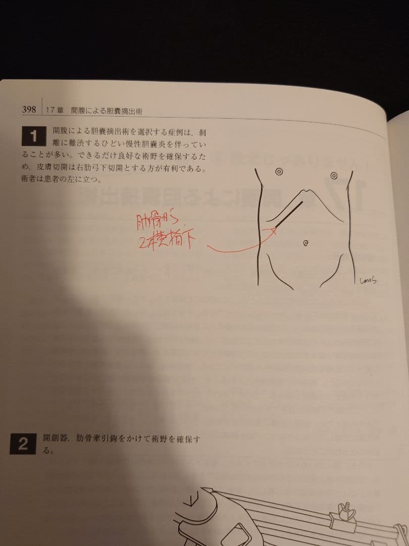 イラストレイテッド外科手術 第3版　縮刷版