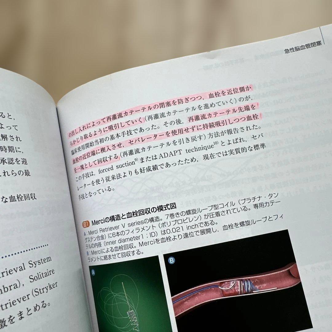 パーフェクトマスター 脳血管内治療 改訂第2版