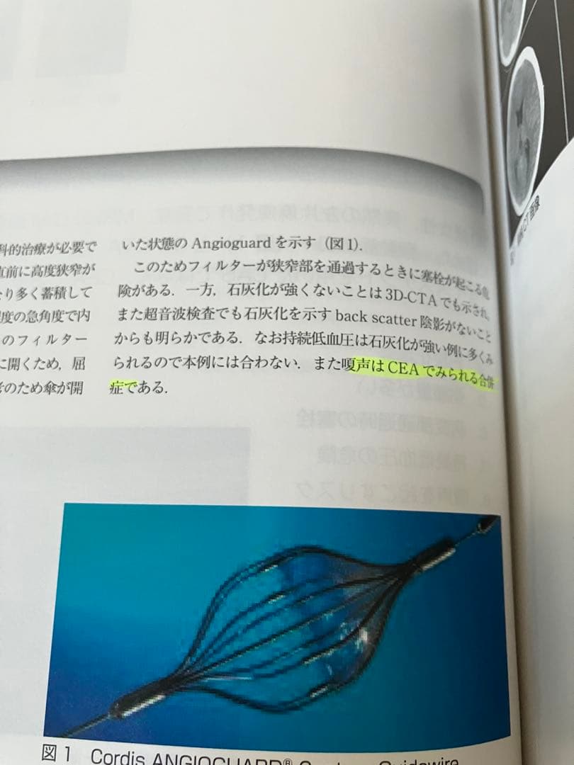脳卒中専門医試験 問題・解説集
