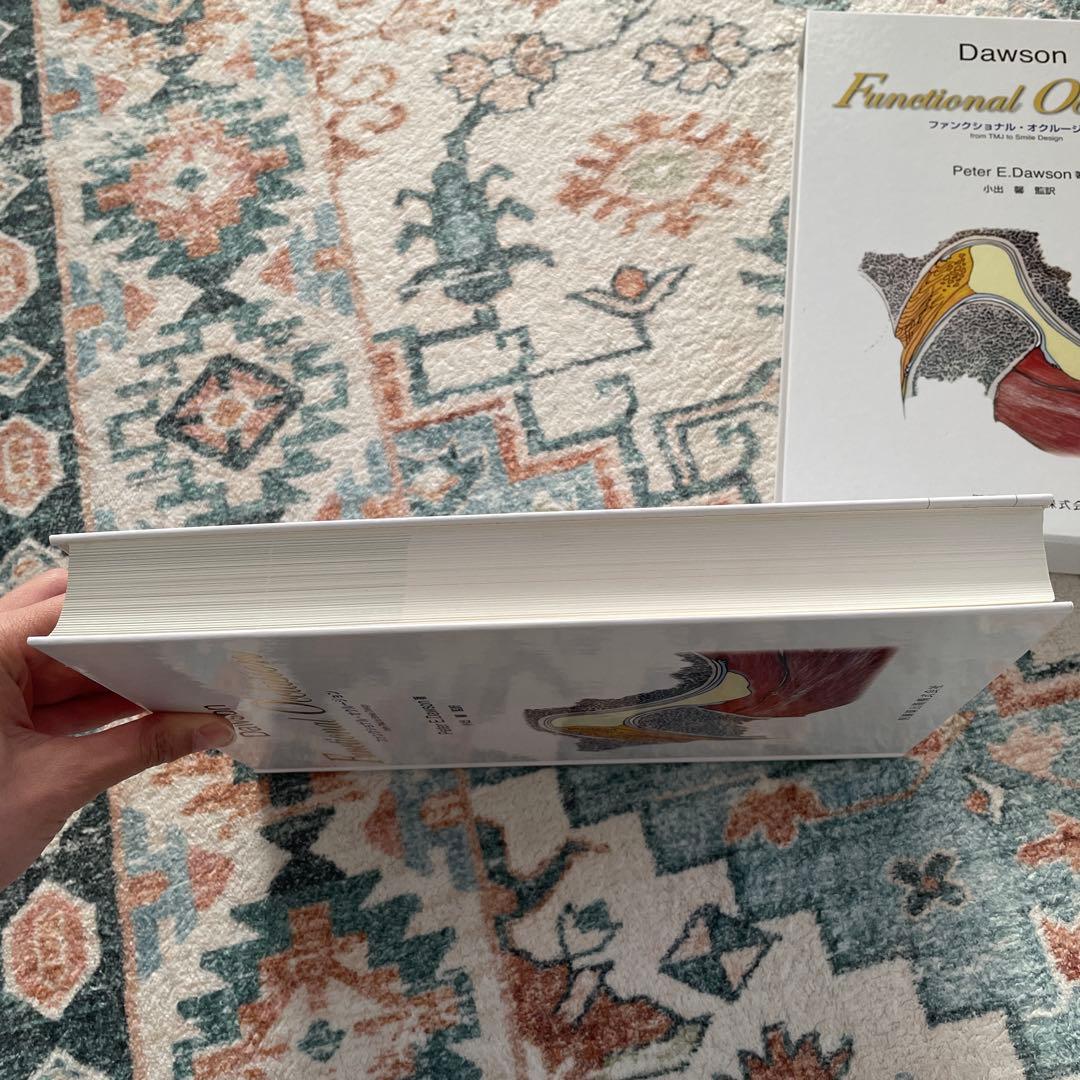 ファンクショナル　オクルージョン