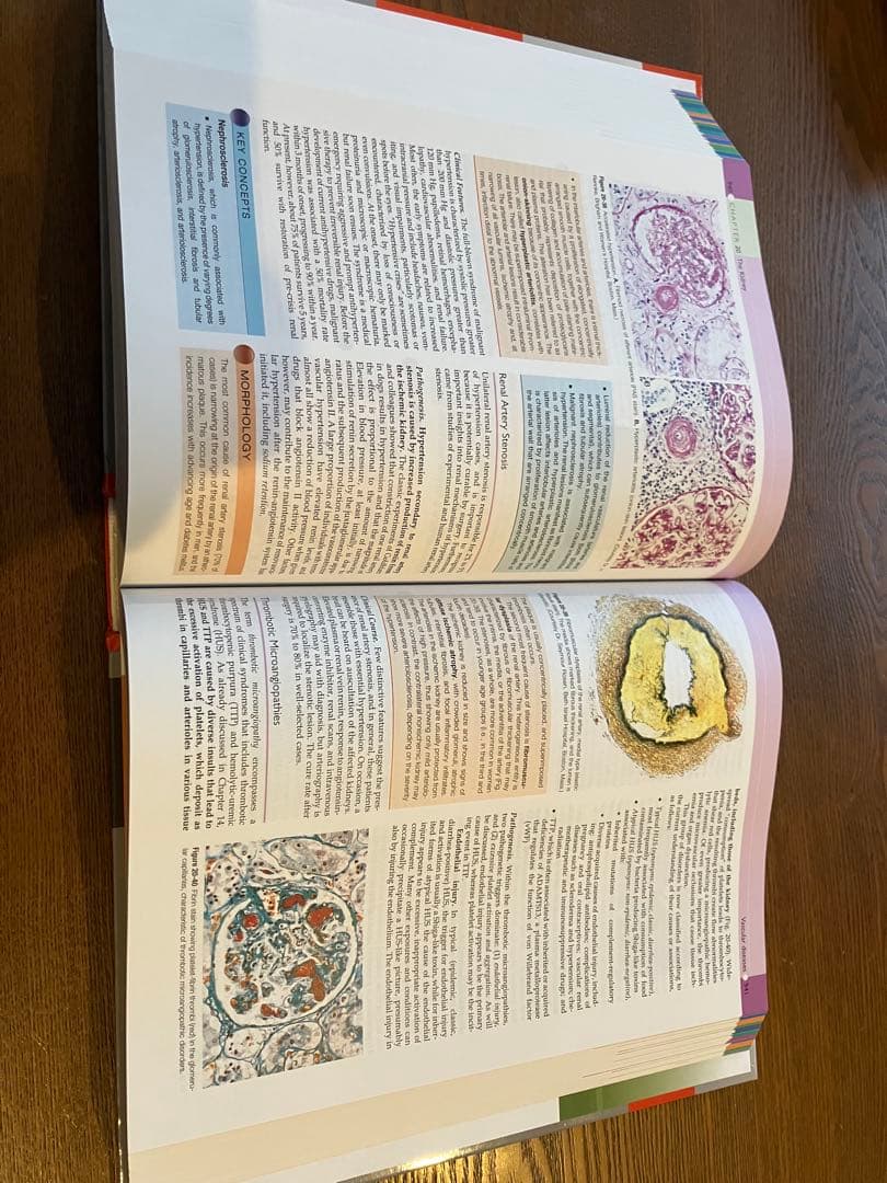 未使用Robbins and Cotran PATHOLOGIC 病理学