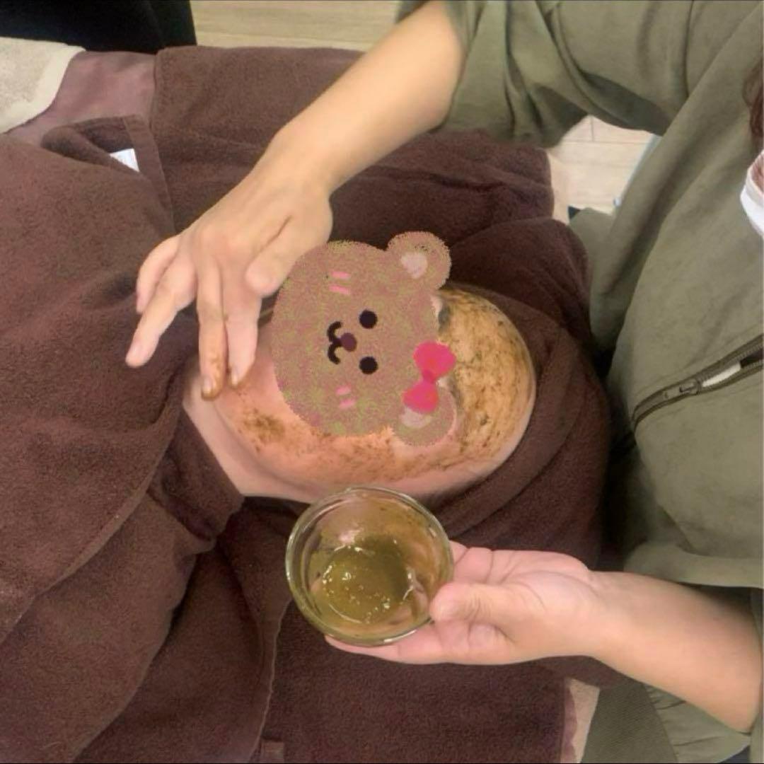 専用ハーブピーリング剥離無し　10回分（11月11日から2月20日の間発送停止)