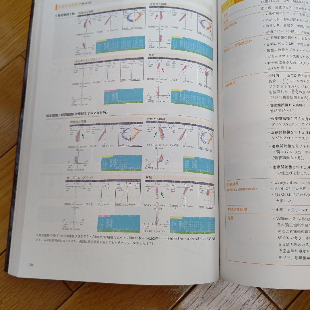 全顎矯正と部分矯正へのアプローチ : 非抜歯治療と抜歯治療の選択基準