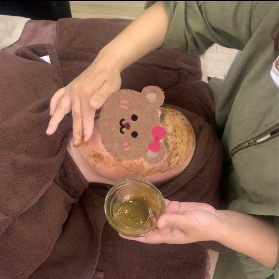 ハーブピーリング剥離無し　10回分