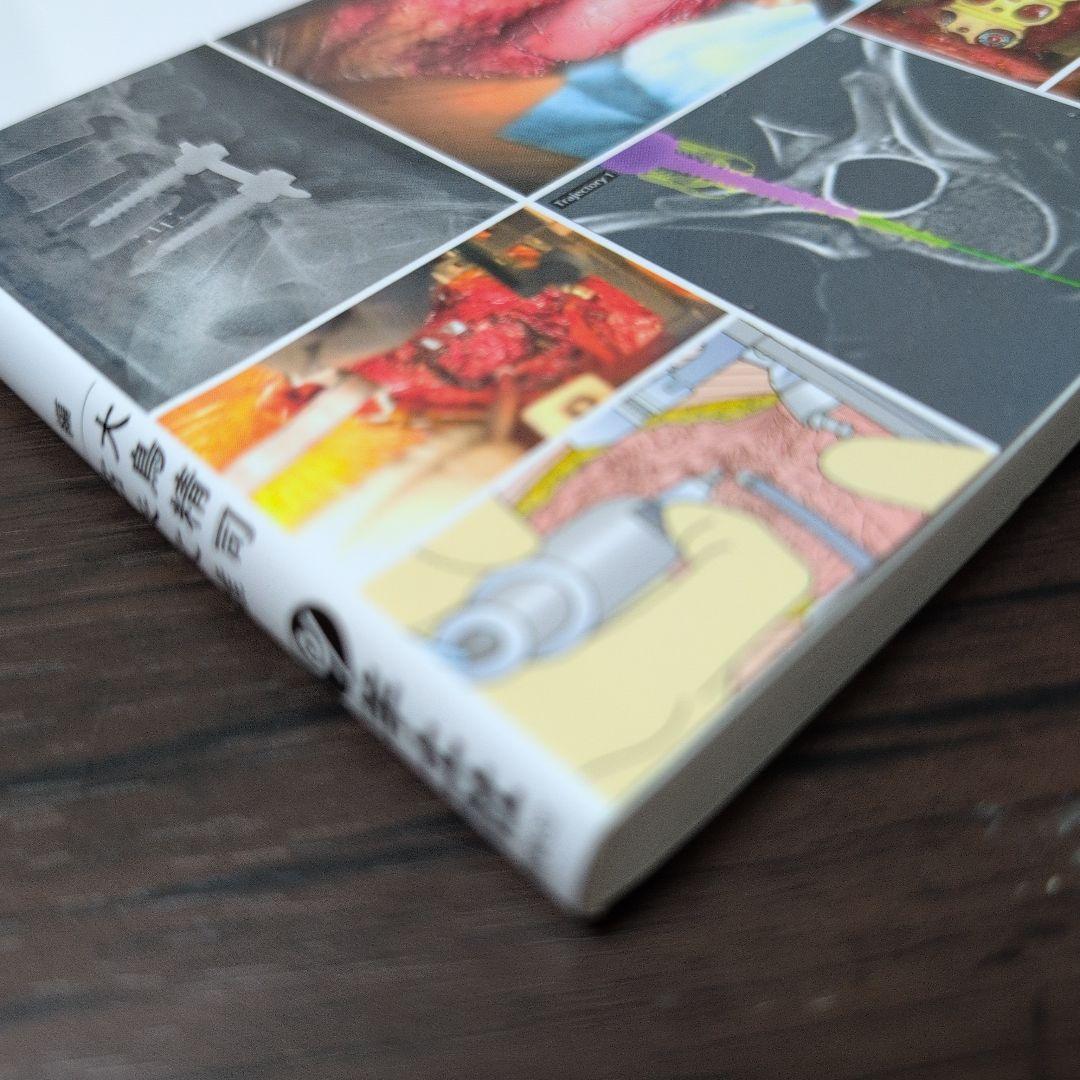 脊椎手術パーフェクト SPINE