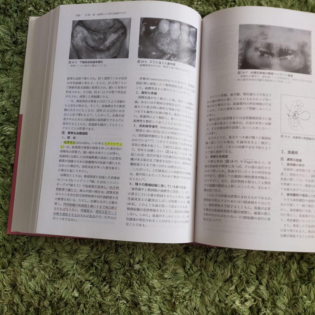 口腔外科　第2版