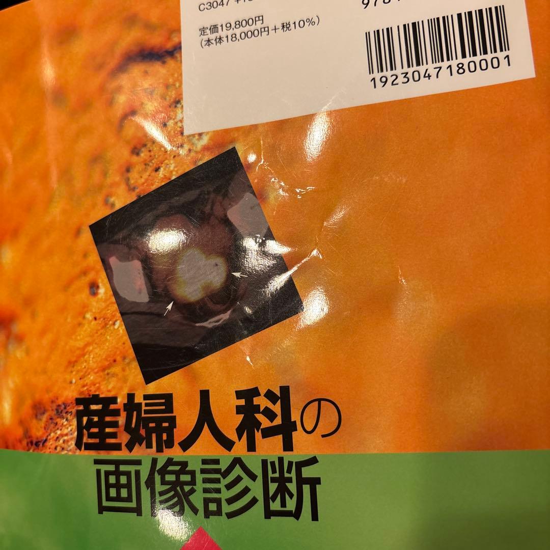 産婦人科の画像診断 第2版