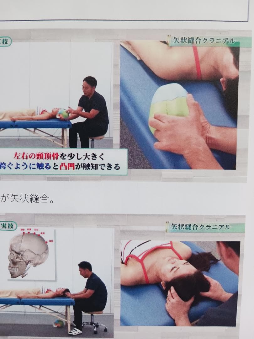 頭蓋縫合治療　縫合にアプローチして全身調整するクラニアル　Time Reset