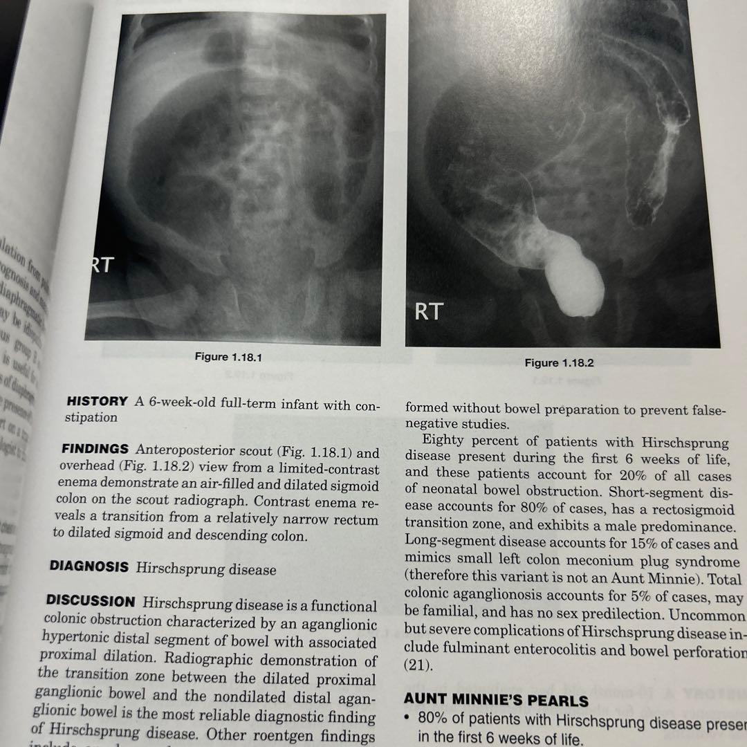 Aunt Minnie's Atlas 画像診断 第3版 洋書 医学書 放射線科