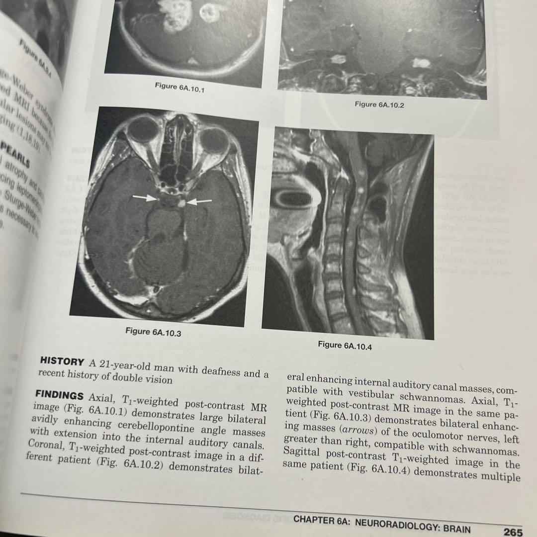 Aunt Minnie's Atlas 画像診断 第3版 洋書 医学書 放射線科