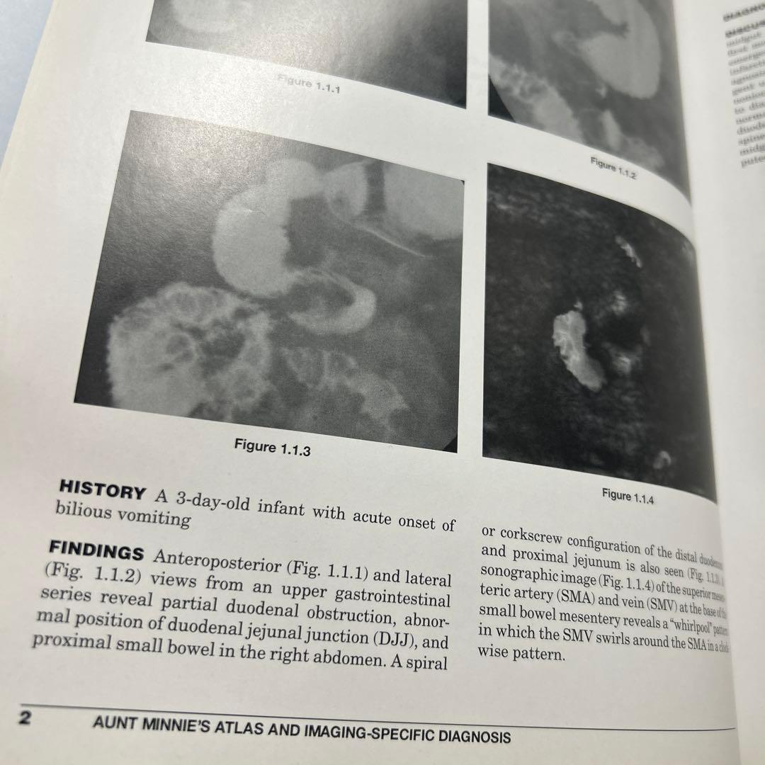 Aunt Minnie's Atlas 画像診断 第3版 洋書 医学書 放射線科