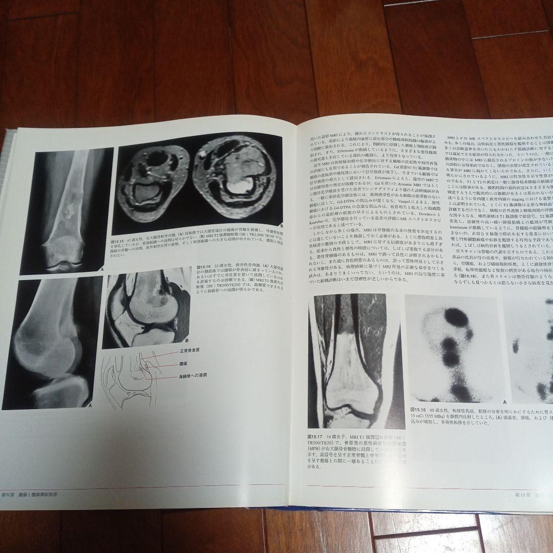 整形外科　放射線診断学　医学　医療