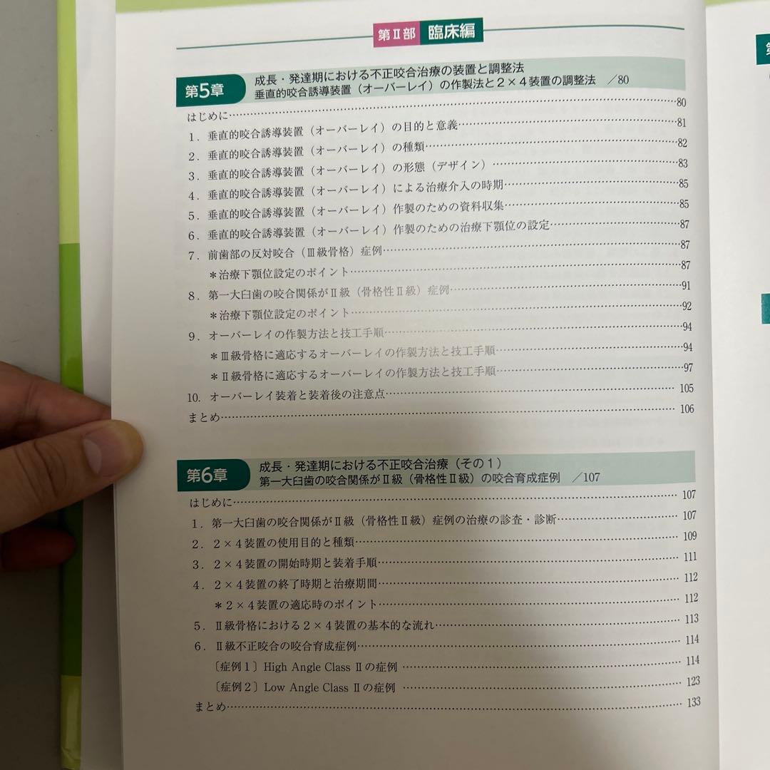 成長・発達期における不正咬合の早期治療