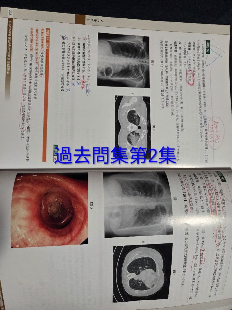 日本内科学会 過去問題集 その他、 内科専門医 総合内科専門医、ジャンク