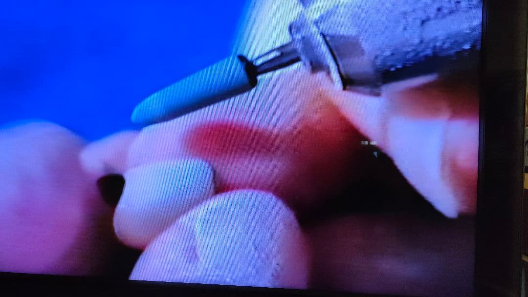 青嶋仁　先生　テーブルクリニックビデオ歯科技工　セラミック　ポーセレン