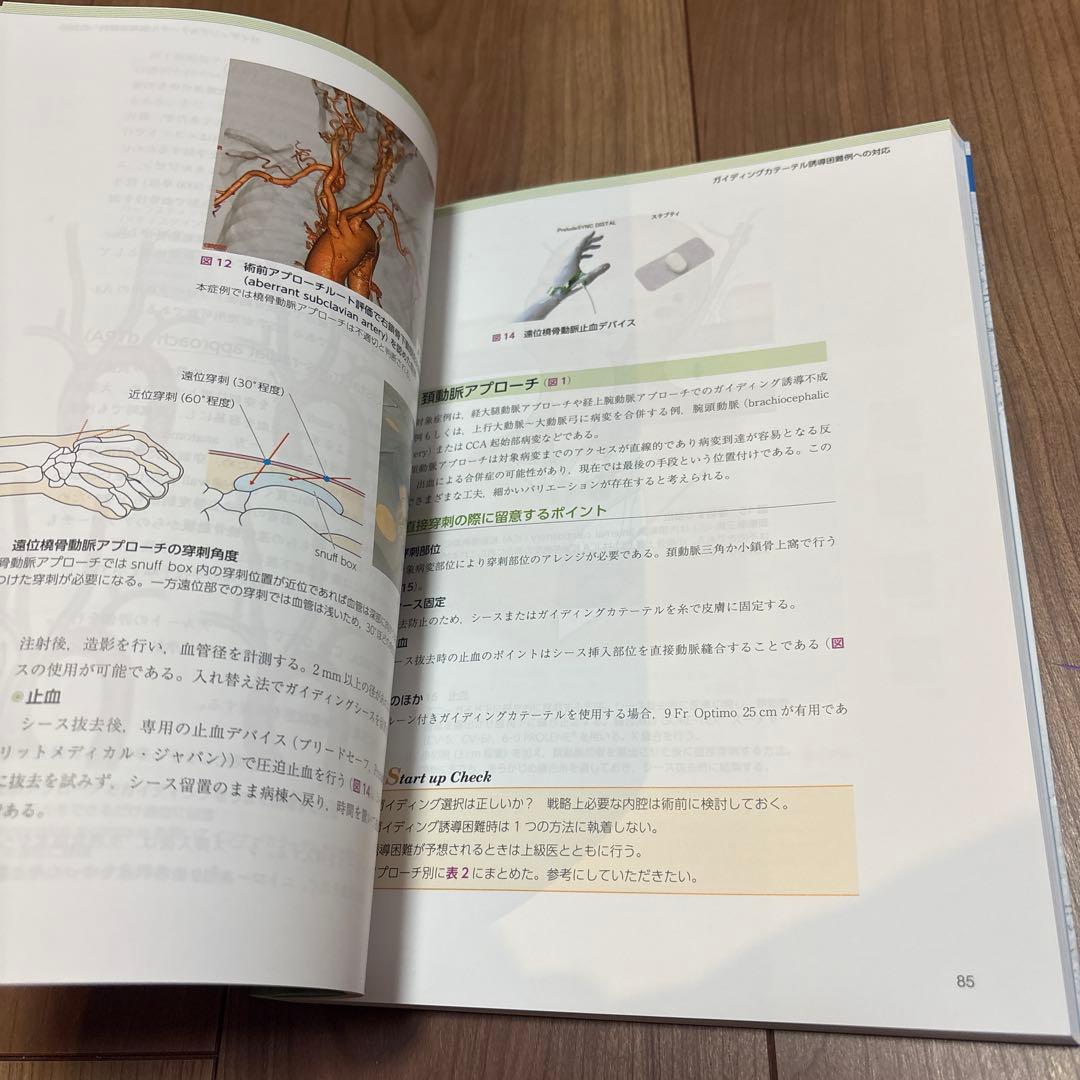 脳血管内治療 スタート&スタンダード